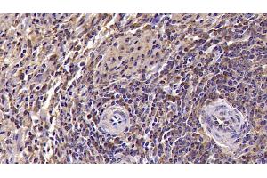 Immunohistochemistry (IHC) image for anti-Killer Cell Lectin-Like Receptor Subfamily D, Member 1 (KLRD1) (AA 32-179) antibody (ABIN7428755)