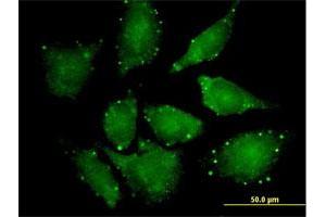 Immunofluorescence (IF) image for anti-Eukaryotic Translation Initiation Factor 4E Nuclear Import Factor 1 (EIF4ENIF1) (AA 1-985) antibody (ABIN527919)