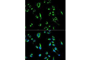 Immunofluorescence analysis of MCF7 cell using APOBEC3G antibody. (APOBEC3G 抗体  (AA 60-330))