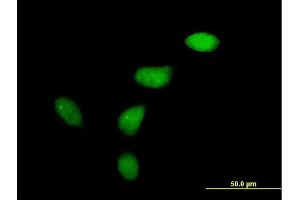 Immunofluorescence of purified MaxPab antibody to WEE1 on HeLa cell. (WEE1 抗体  (AA 1-646))