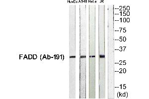 Western blot analysis of extracts from HuvEc cells, A549 cells, HeLa cells and JurKat cells, using FADD (Ab-191) antibody.