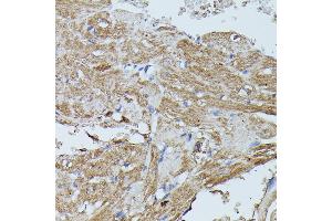 Immunohistochemistry of paraffin-embedded mouse heart using FLII antibody (ABIN7267217) at dilution of 1:100 (40x lens). (FLII 抗体  (AA 400-660))