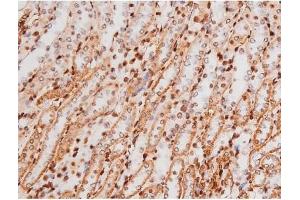 Immunohistochemistry (IHC) image for anti-Mast/stem Cell Growth Factor Receptor (KIT) (pTyr721) antibody (ABIN6256004)