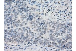 Immunohistochemical staining of paraffin-embedded Ovary tissue using anti-PORmouse monoclonal antibody. (POR 抗体)