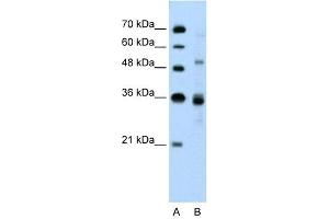 WB Suggested Anti-TNRC4 Antibody Titration: 0. (CELF3 抗体  (N-Term))