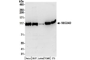 anti-SEC24 Family, Member D (S. Cerevisiae) (SEC24D) (AA 1-50) antibody