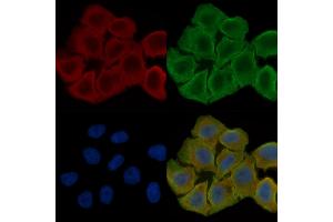 ABIN6257247 and ABIN6274671 staining Hela cells(30 min of UV treatment) by IF/ICC.