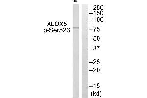 Western blot analysis of extracts from Jurkat cells, using ALOX5 (Phospho-Ser523) Antibody. (ALOX5 抗体  (pSer523))