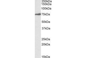 Western Blotting (WB) image for anti-Ribosomal L1 Domain Containing 1 (RSL1D1) (Internal Region) antibody (ABIN2464593) (RSL1D1 抗体  (Internal Region))