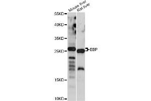 Western blot analysis of extracts of various cell lines, using EBP antibody.