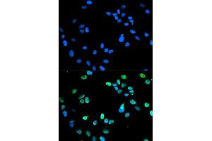 Immunofluorescence analysis of HeLa cell using IRF5 antibody. (IRF5 抗体)