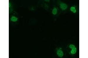 Anti-UCK1 mouse monoclonal antibody (ABIN2453771) immunofluorescent staining of COS7 cells transiently transfected by pCMV6-ENTRY UCK1 (RC220876). (UCK1 抗体)