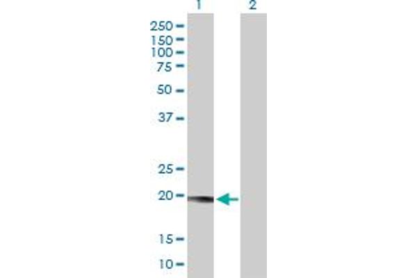 Lysozyme-Like 1 抗体  (AA 1-194)