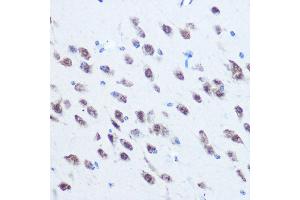 Immunohistochemistry (IHC) image for anti-Poly(rC) Binding Protein 2 (PCBP2) (AA 1-130) antibody (ABIN3023340)