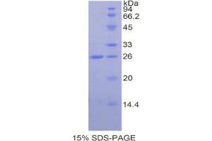 SDS-PAGE analysis of Rat alpha Fodrin Protein. (SPTAN1 蛋白)