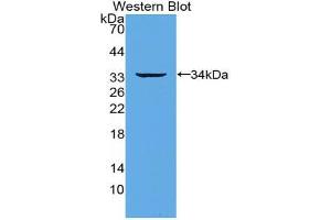 Western blot analysis of the recombinant protein. (TNFRSF11A 抗体  (AA 330-615))