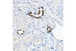 Immunohistochemistry of paraffin-embedded rat kidney using EVA Rabbit pAb  at dilution of 1:100 (40x lens). (TMEM166 抗体)