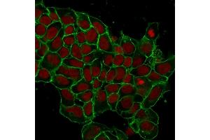 Immunofluorescent staining of MCF-7 cells. (EpCAM 抗体  (Extracellular Domain))