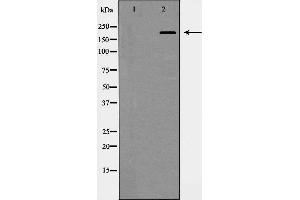 Western blot analysis of Integrin β4 expression in HepG2 cells. (Integrin beta 4 抗体  (C-Term))
