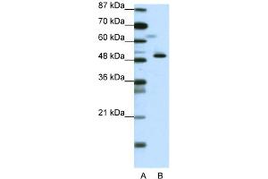 WB Suggested Anti-ZNF259 Antibody Titration:  0. (ZNF259 抗体  (N-Term))