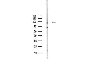 Western blot analysis of lysates from Mouse lung, using C Antibody at 1/1000 dilution.