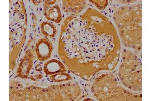 IHC image of ABIN7156191 diluted at 1:100 and staining in paraffin-embedded human kidney tissue performed on a Leica BondTM system. (PTK7 抗体  (AA 772-1070))