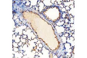 IHC analysis of CD31/Pecam1 using anti-CD31/Pecam1 antibody (ABIN7601662). (CD31 抗体  (AA 41-258))