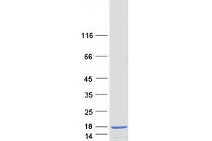 Western Blotting (WB) image for S100 Calcium Binding Protein A4 (S100A4) (Transcript Variant 2) protein (Myc-DYKDDDDK Tag) (ABIN2731306)