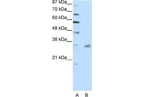 WB Suggested Anti-PITX3 Antibody Titration:  0. (PITX3 抗体  (N-Term))