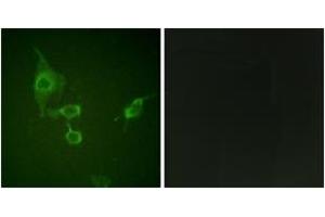 Immunofluorescence analysis of HepG2 cells, using HCK (Ab-410) Antibody. (HCK 抗体  (AA 381-430))