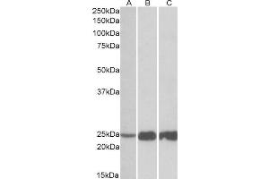 ABIN1590039 (0. (TNNI2 抗体  (N-Term))