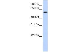 WB Suggested Anti-DNTT Antibody Titration: 0. (TdT 抗体  (Middle Region))
