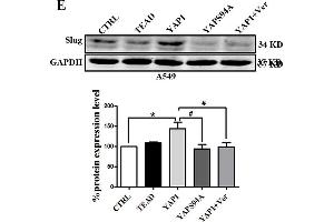 Slug is regulated by the co-transcriptional complex YAP1/TEAD in the EMT program of A549 cells. (GAPDH 抗体)