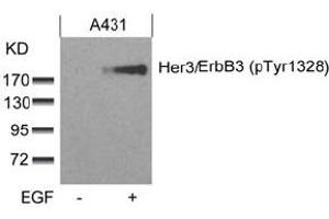 Image no. 2 for anti-Receptor Tyrosine-Protein Kinase ErbB-3 (ERBB3) (pTyr1328) antibody (ABIN319273) (ERBB3 抗体  (pTyr1328))