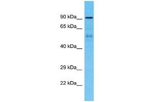 Host:  Rabbit  Target Name:  ZNF658B  Sample Type:  Breast Tumor lysates  Antibody Dilution:  1.
