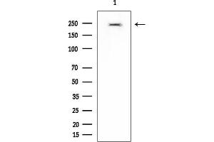 Western blot analysis of lysates from PC12 cells, using NuMA Mouse Monoclonal Antibody at 1/1000 dilution.