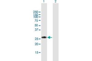 Western Blot analysis of RPIA expression in transfected 293T cell line by RPIA MaxPab polyclonal antibody. (Ribose 5-Phosphate Isomerase A (RPIA) (AA 1-237) 抗体)