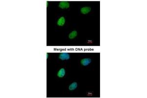 ICC/IF Image Immunofluorescence analysis of paraformaldehyde-fixed HeLa, using ITPK1, antibody at 1:200 dilution. (ITPK1 抗体)