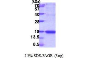 SDS-PAGE (SDS) image for Interleukin 18 (IL18) (AA 36-192) protein (ABIN6387557) (IL-18 Protein (AA 36-192))