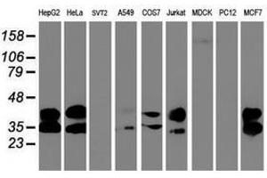 Image no. 5 for anti-Uracil-DNA Glycosylase (UNG) antibody (ABIN1501681) (UNG 抗体)