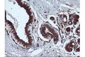 Image no. 5 for anti-Armadillo Repeat Containing 1 (ARMC1) antibody (ABIN1496724)