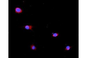 IF analysis of GLB1 using anti-GLB1 antibody (ABIN7599649). (GLB1 抗体  (AA 103-646))