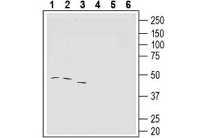 Western blot analysis of human K562 erythroleukemia cell line lysate (lanes 1 and 4), human Jurkat T-cell leukemia cell line lysate (lanes 2 and 5) and human LNCaP prostate adenocarcinoma cell line lysate (lanes 3 and 6):1-3. (Tetraspanin 3 抗体  (Extracellular))