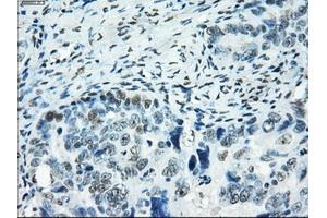 Immunohistochemical staining of paraffin-embedded colon tissue using anti-SATB1mouse monoclonal antibody. (SATB1 抗体)
