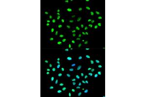 Immunofluorescence analysis of MCF-7 cells using HNRNPK antibody (ABIN5970850). (HNRNPK 抗体)