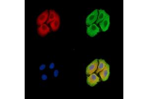 ABIN7096484 and ABIN7100548 staining Hela cells by IF/ICC. (TMEM107 抗体)