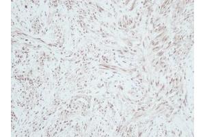 Image no. 1 for anti-gamma-Interferon-Induced Monokine (CXCL9) antibody (ABIN465878) (CXCL9 抗体)