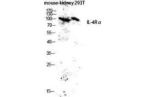 Western Blot (WB) analysis of Mouse Kidney 293T lysis using IL-4Ralpha antibody. (IL4 Receptor 抗体  (Ser540))