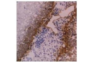 Cryostat section of human tonsil stained with anti-CD104 antibody ABIN118872 (Integrin beta 4 抗体)