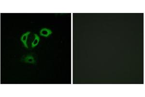 Immunofluorescence analysis of A549cells, using TACC3 antibody. (TACC3 抗体  (C-Term))
